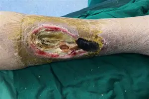 米兰体育APP下载-多特蒙德今晨止住颓势纽卡斯尔更衣室发声备战法国杯，国际比赛日德甲焦点战瞬间刷屏的简单介绍